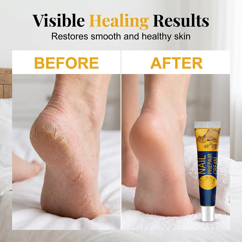 🧴Magic  Foot Repair Balm – Clear Smooth Heels in Days
