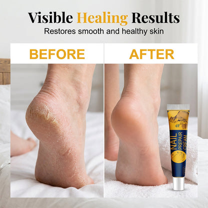 🧴Magic  Foot Repair Balm – Clear Smooth Heels in Days