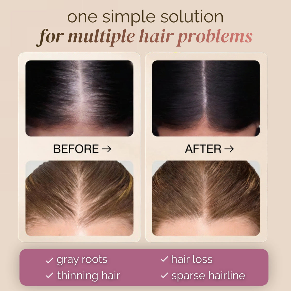 💇‍♀️ Instant Root Touch-Up & Hair Line Concealer Stick