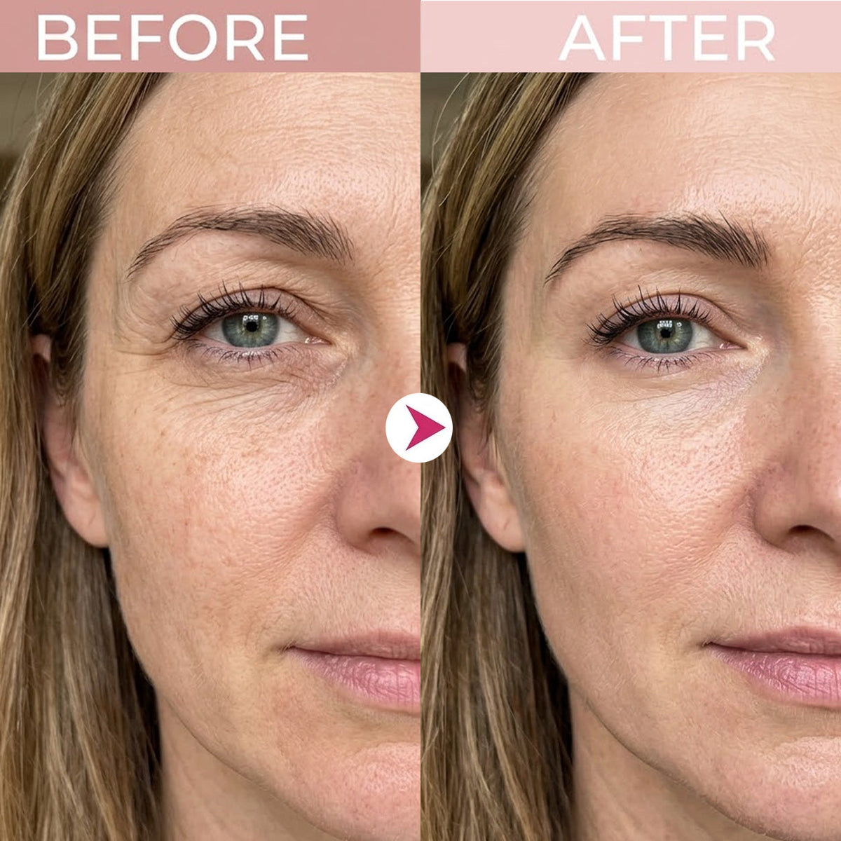 ✨ Instant Eye Lift & Firming Renewal Cream