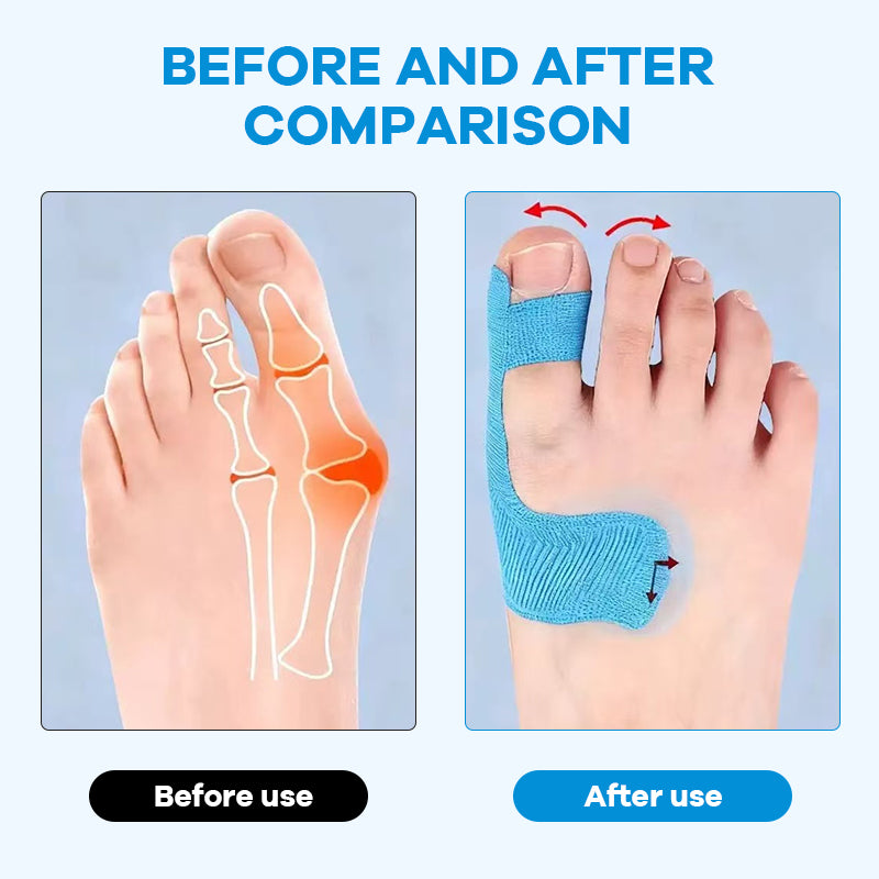 pre-cut-bunion-corrector-kinesiology-tape-2227