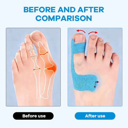 pre-cut-bunion-corrector-kinesiology-tape-2227