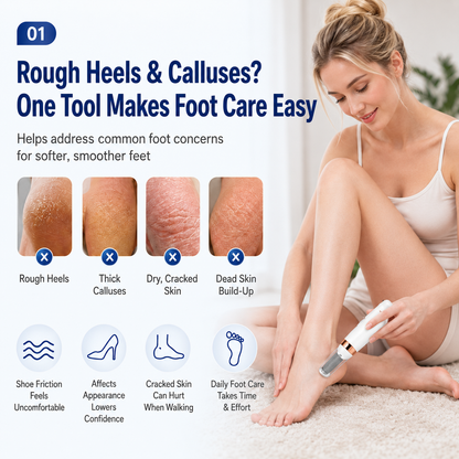 Electric Foot Callus Remover | USB-C Pedicure Tool